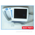 Veterinary Palm Ultrasound Scanner Machine with Linear Array Probe